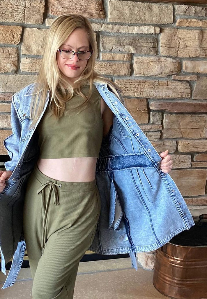 Bikini News Daily Mikayla Holmgren Is Determined To Become The First Model With Down Syndrome